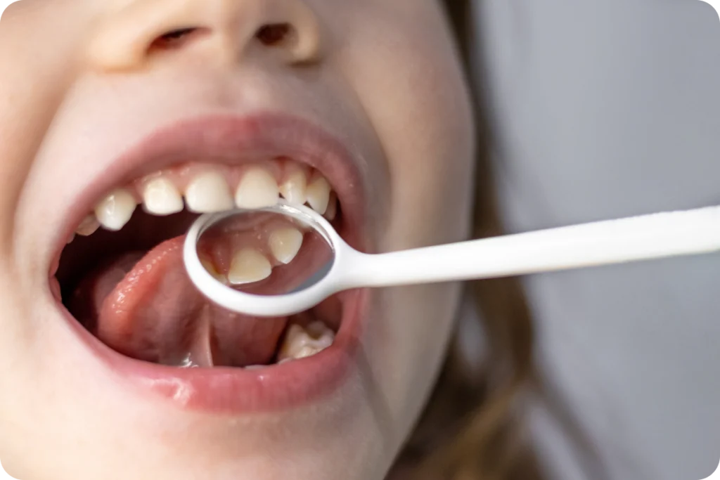 Soins dentaires chez l’enfant SNT, Dentistes à Vaires-sur-Marne
