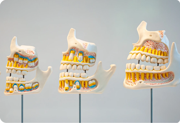 Soins dentaires chez l’enfant SNT, Dentistes à Vaires-sur-Marne