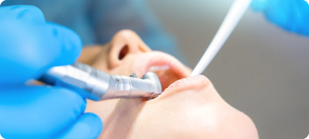 Extraction de dents SNT, Dentistes à Vaires-sur-Marne