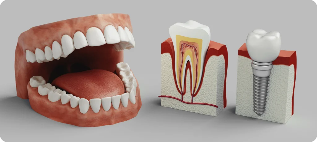 Implant dentaire SNT, Dentistes à Vaires-sur-Marne