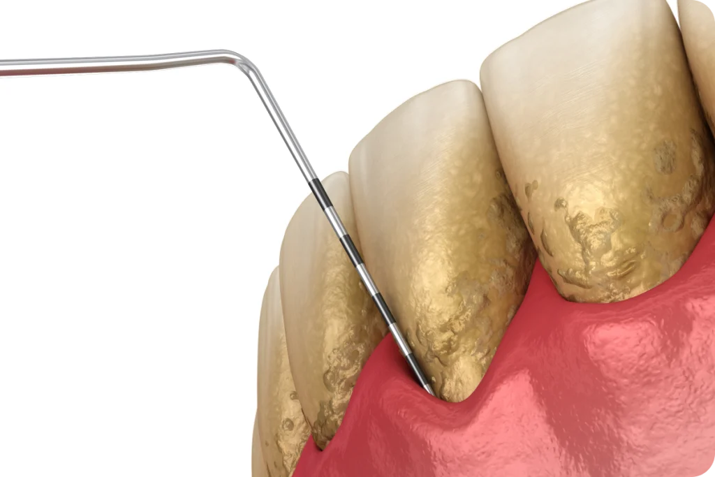 Traitement des maladies des gencives SNT, Dentistes à Vaires-sur-Marne