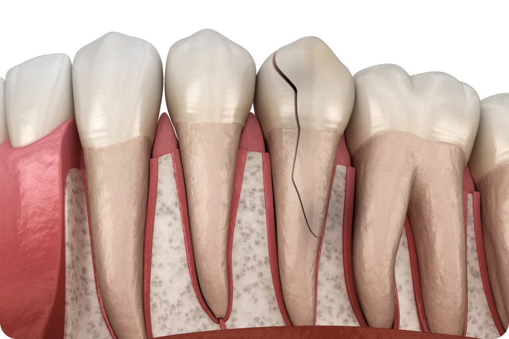Soins esthétiques restaurateurs SNT, Dentistes à Vaires-sur-Marne