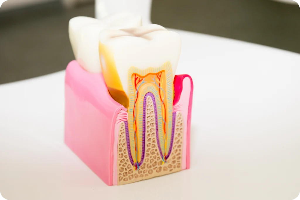 Traitement endodontique SNT, Dentistes à Vaires-sur-Marne