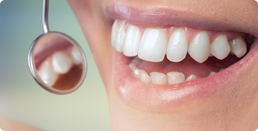 Miroir dentaire approché d'un sourire aux dents blanches