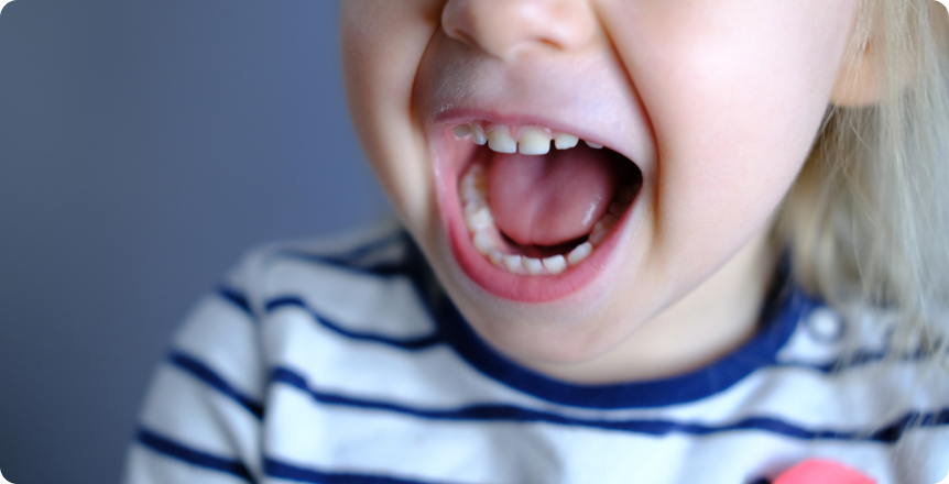 Enfant riant aux éclats, dents de lait visibles